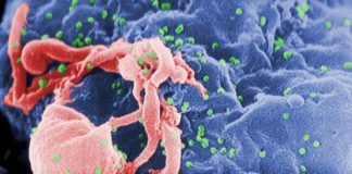 Man in london survived HIV virus